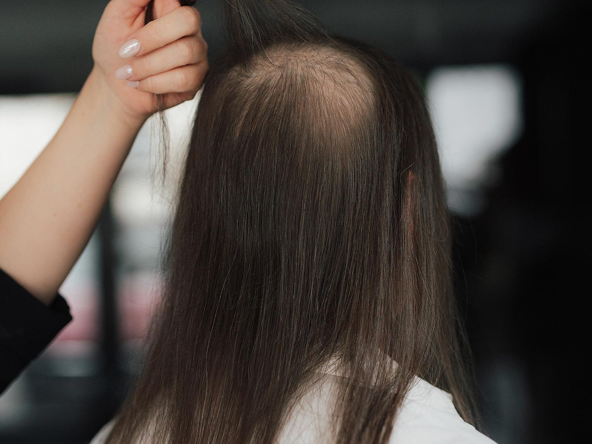Mehr als Haarverlust. Neue Perspektiven.